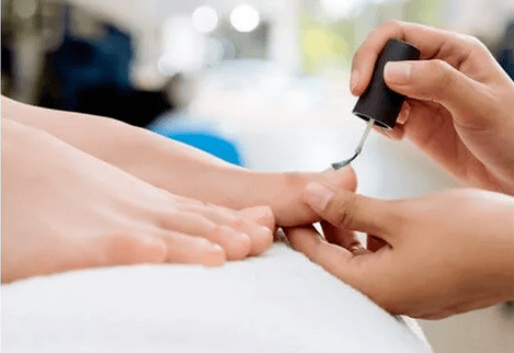 Λάκαρα μύγας