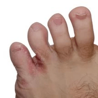 Μανιτάρι ανάμεσα στα δάχτυλα